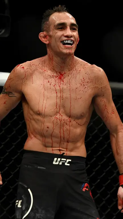 Tony Ferguson